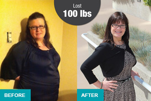 Update: Molina Employee Loses 100 Pounds, No Longer Diabetic